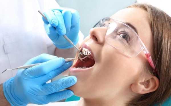 孕妇可以洗牙齿吗,怀孕期间能洗牙吗有影响吗 第2张 孕妇可以洗牙齿吗,怀孕期间能洗牙吗有影响吗 第2张