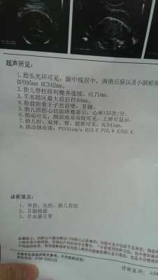 37周胎儿偏小(胎儿懒得动是什么原因?怀孕37周胎动减少怎么办) 第1张 37周胎儿偏小(胎儿懒得动是什么原因?怀孕37周胎动减少怎么办) 第1张