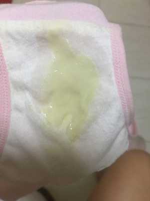 羊水是氧气水吗,胎儿洋水破了多久能生 第3张 羊水是氧气水吗,胎儿洋水破了多久能生 第3张