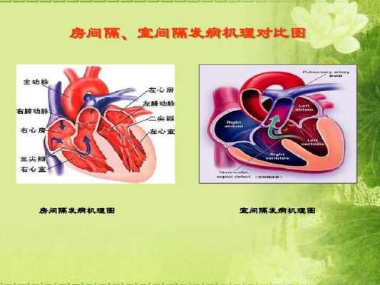 胎儿房缺(胎儿房缺室缺能留下来吗) 第1张 胎儿房缺(胎儿房缺室缺能留下来吗) 第1张