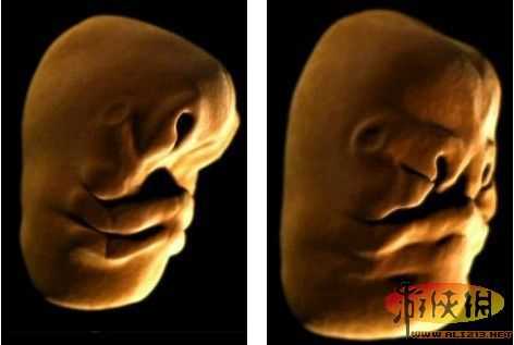 纪录片胎儿(沃福妈妈生宝宝是哪一集) 第3张 纪录片胎儿(沃福妈妈生宝宝是哪一集) 第3张