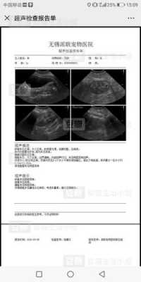 胎儿多囊肾还能要吗(女朋友有家族遗传病,多囊肾,我该怎么办?要不要和她结婚) 第3张 胎儿多囊肾还能要吗(女朋友有家族遗传病,多囊肾,我该怎么办?要不要和她结婚) 第3张