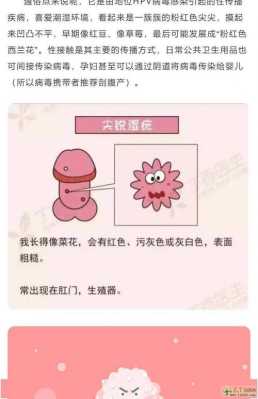 孕妇得了尖锐湿疣如何治疗,孕期得了尖疣有没有影响 第1张 孕妇得了尖锐湿疣如何治疗,孕期得了尖疣有没有影响 第1张