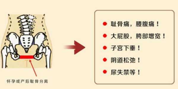 孕25周，翻身时总感觉耻骨疼是怎么回事,孕期耻骨分离的症状有哪些  第2张