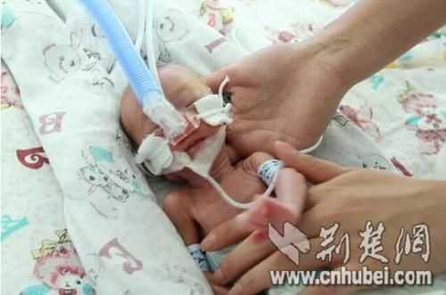 怀孕六周胎儿有多大(怀孕六个月的小孩子应该长成什么样了?六个月就生出来会怎么样) 第2张 怀孕六周胎儿有多大(怀孕六个月的小孩子应该长成什么样了?六个月就生出来会怎么样) 第2张