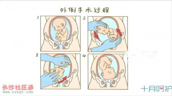 如何让胎儿快速发动(38周了如何让胎儿快速发动) 第1张 如何让胎儿快速发动(38周了如何让胎儿快速发动) 第1张