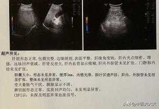 b超检查胎儿胆囊偏大该怎么办?请问胎儿胆囊大有什么坏处,胎儿胆囊偏大严重吗? 第2张 b超检查胎儿胆囊偏大该怎么办?请问胎儿胆囊大有什么坏处,胎儿胆囊偏大严重吗? 第2张