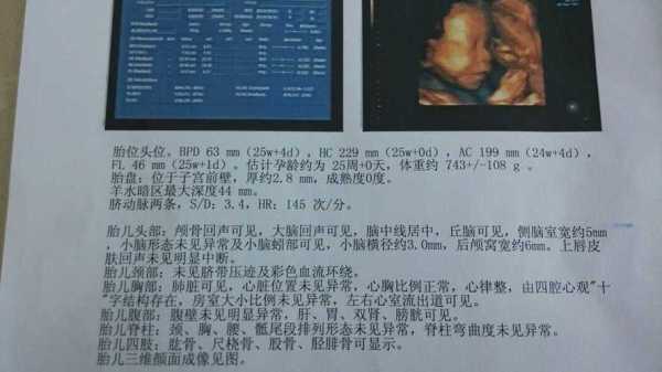 孕24周胎儿小脑横径是怎么回事呢?医生也没有说有什么问题,孕24周胎儿发育指标数据表 第1张 孕24周胎儿小脑横径是怎么回事呢?医生也没有说有什么问题,孕24周胎儿发育指标数据表 第1张