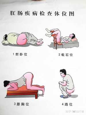 备孕一定要割痔疮吗,备孕期痔疮犯了怎么办 第2张 备孕一定要割痔疮吗,备孕期痔疮犯了怎么办 第2张