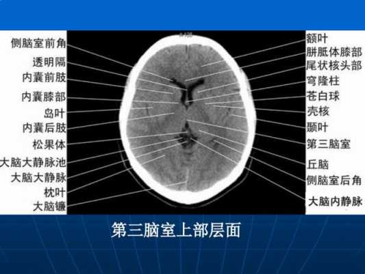 胎儿第三脑室正常值(胎儿第三脑室正常值是3mm还是10mm) 第1张 胎儿第三脑室正常值(胎儿第三脑室正常值是3mm还是10mm) 第1张