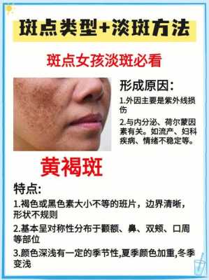 防止长斑的正确方法,孕期预防长斑的方法 第2张 防止长斑的正确方法,孕期预防长斑的方法 第2张