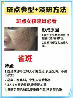 防止长斑的正确方法,孕期预防长斑的方法 第3张 防止长斑的正确方法,孕期预防长斑的方法 第3张