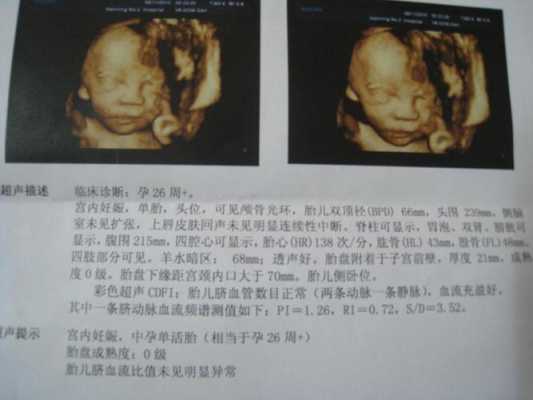 胎儿常规彩超检查什么(宝宝四维彩超是什么) 第1张 胎儿常规彩超检查什么(宝宝四维彩超是什么) 第1张