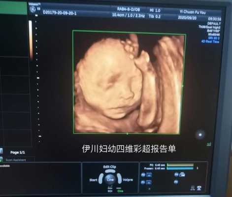 胎儿常规彩超检查什么(宝宝四维彩超是什么) 第2张 胎儿常规彩超检查什么(宝宝四维彩超是什么) 第2张
