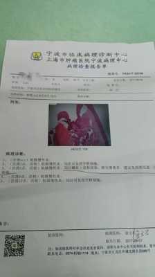 什么是泰纳检验,孕期活检是什么 第3张 什么是泰纳检验,孕期活检是什么 第3张