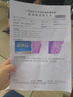 什么是泰纳检验,孕期活检是什么 第2张 什么是泰纳检验,孕期活检是什么 第2张