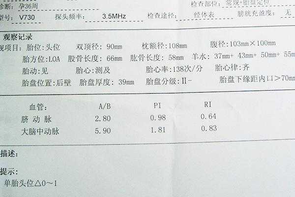 l和p哪个是左,胎儿lop位是什么意思 第2张 l和p哪个是左,胎儿lop位是什么意思 第2张