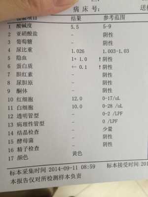 孕期尿碱性(孕妇尿检酸碱度7.5正常吗) 第1张 孕期尿碱性(孕妇尿检酸碱度7.5正常吗) 第1张