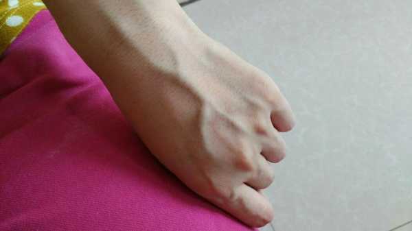孕期有青筋（孕期青筋暴起是什么原因）  第2张