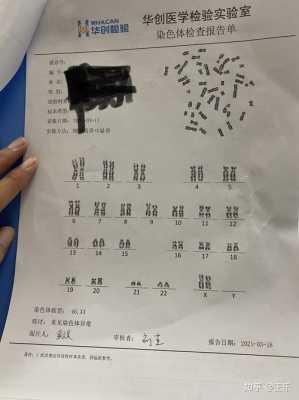 胎儿染色体多(胎儿染色体异常有什么后果) 第2张 胎儿染色体多(胎儿染色体异常有什么后果) 第2张
