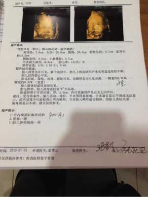 怀孕六个月胎儿彩超(怀孕六个月胎儿彩超视频) 第2张 怀孕六个月胎儿彩超(怀孕六个月胎儿彩超视频) 第2张