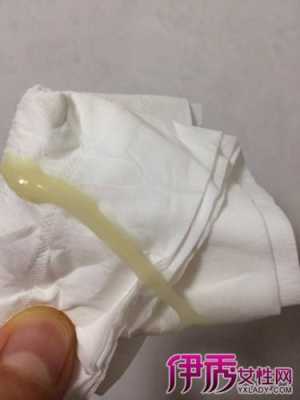 怀孕期间会有白带吗, 第3张 怀孕期间会有白带吗, 第3张
