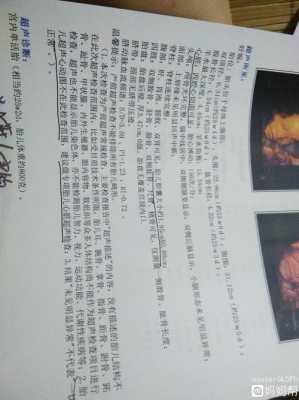 胎儿胆囊大怎么办(胎儿胆囊大怎么办?) 第1张 胎儿胆囊大怎么办(胎儿胆囊大怎么办?) 第1张
