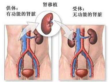 胎儿双肾集合部分离(怀孕七个月胎儿双肾集合系统分离是什么原因) 第1张 胎儿双肾集合部分离(怀孕七个月胎儿双肾集合系统分离是什么原因) 第1张