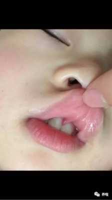 胎儿发黑(宝宝长牙的地方变黑了) 第3张 胎儿发黑(宝宝长牙的地方变黑了) 第3张