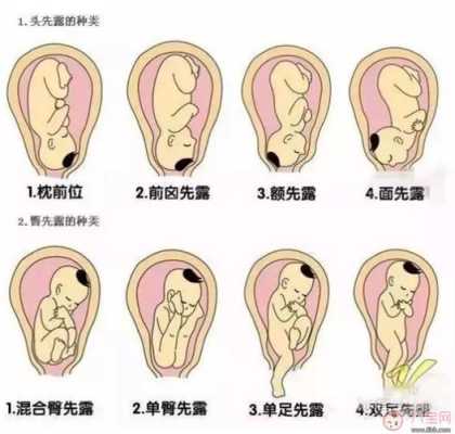 孕晚期胎儿位置图(孕晚期胎儿位置图片) 第2张 孕晚期胎儿位置图(孕晚期胎儿位置图片) 第2张