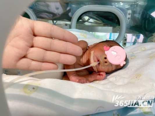 怀孕25周胎儿有多大（怀孕25周胎儿有多大图片）  第2张
