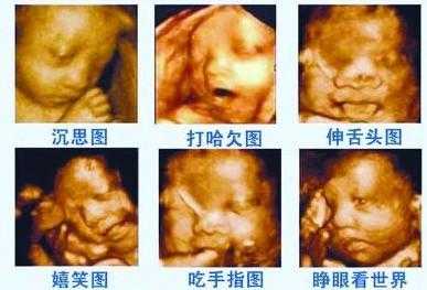 二维彩超和四维彩超区别,胎儿二维彩超检查什么 第1张 二维彩超和四维彩超区别,胎儿二维彩超检查什么 第1张