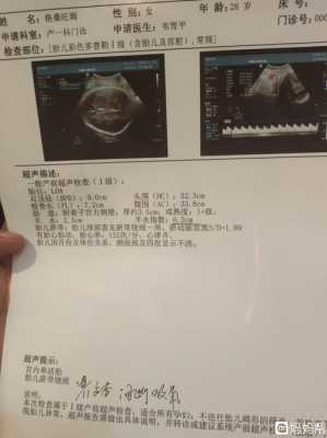 孕期39周(孕39周羊水偏多) 第2张 孕期39周(孕39周羊水偏多) 第2张