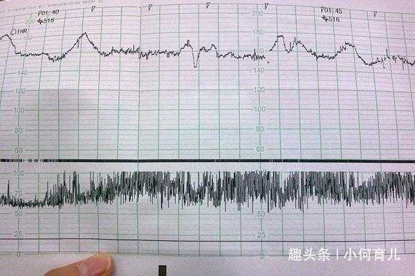 什么原因造成胎儿缺氧(胎心弱主要是因哪些因素引起的) 第2张 什么原因造成胎儿缺氧(胎心弱主要是因哪些因素引起的) 第2张