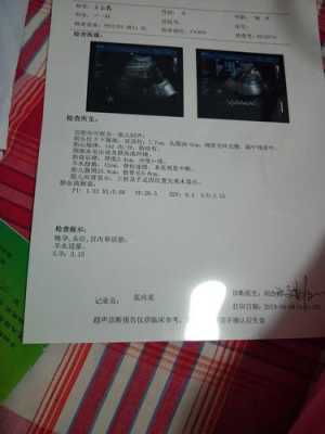 医生说胎头高是什么意思？胎头高胎头高胎头高,胎儿头浮图片  第3张