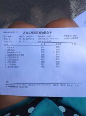 怀孕查出有梅毒,孕期梅毒怎么治疗最好 第2张 怀孕查出有梅毒,孕期梅毒怎么治疗最好 第2张