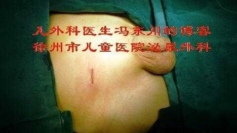宝宝的两个蛋蛋竟然不一样大怎么办呢,胎儿睾丸有积液是怎么回事 第2张 宝宝的两个蛋蛋竟然不一样大怎么办呢,胎儿睾丸有积液是怎么回事 第2张