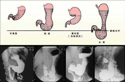 胎儿胃偏小(胎儿胃偏小怎么回事) 第1张 胎儿胃偏小(胎儿胃偏小怎么回事) 第1张