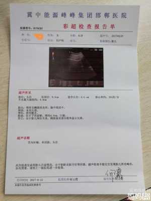胎儿心跳165正常吗(胎儿心跳165正常吗) 第2张 胎儿心跳165正常吗(胎儿心跳165正常吗) 第2张