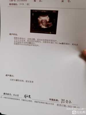孕期彩超图(孕期彩超图片) 第2张 孕期彩超图(孕期彩超图片) 第2张