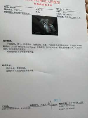 孕期彩超图(孕期彩超图片) 第3张 孕期彩超图(孕期彩超图片) 第3张