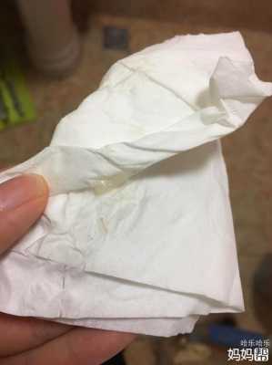 孕期胶状白带(怀孕8周大便之后流出一根粘稠状的白带啥情况) 第3张 孕期胶状白带(怀孕8周大便之后流出一根粘稠状的白带啥情况) 第3张
