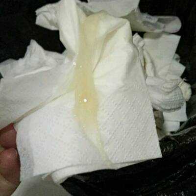 孕期胶状白带(怀孕8周大便之后流出一根粘稠状的白带啥情况) 第2张 孕期胶状白带(怀孕8周大便之后流出一根粘稠状的白带啥情况) 第2张