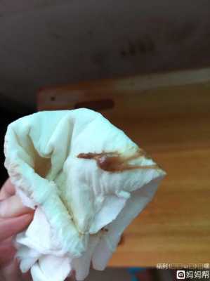 孕妇积液对胎儿影响吗（积液是到底是水还是血）  第1张