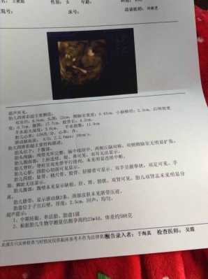 常规胎儿(常规胎儿超声检查) 第2张 常规胎儿(常规胎儿超声检查) 第2张