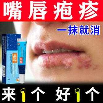 孕期嘴巴上火起泡怎么办(上火嘴唇起泡吃什么药好) 第1张 孕期嘴巴上火起泡怎么办(上火嘴唇起泡吃什么药好) 第1张