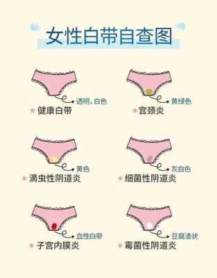 孕期白带发黄是什么原因(孕期分泌物颜色对照表) 第1张 孕期白带发黄是什么原因(孕期分泌物颜色对照表) 第1张