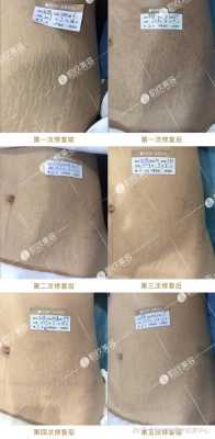 孕期长妊娠纹痒怎么办(孕妇妊娠纹痒可以涂炉甘石吗) 第2张 孕期长妊娠纹痒怎么办(孕妇妊娠纹痒可以涂炉甘石吗) 第2张