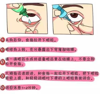 孕妇能滴眼药水吗,怀孕滴眼药水对胎儿有影响吗 第1张 孕妇能滴眼药水吗,怀孕滴眼药水对胎儿有影响吗 第1张