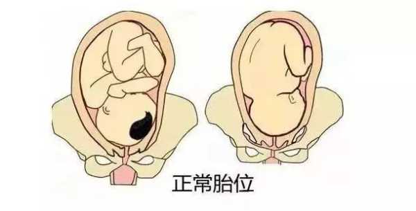 胎儿头不正(胎儿头不正) 第2张 胎儿头不正(胎儿头不正) 第2张